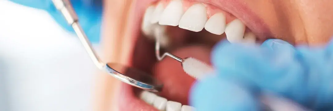 Zahnärztliche Untersuchung (Symboldbild)