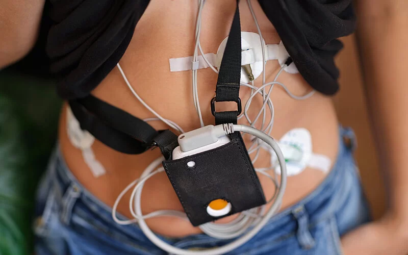 Eine junge Frau trägt Elektroden am Körper und ein Langzeit-EKG-Gerät um den Hals.