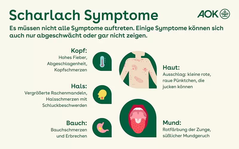 Die Infografik zeigt die Symptome von Scharlach. Sie ist in fünf Abschnitte unterteilt: Kopf, Hals, Haut, Bauch und Mund. Jeder Abschnitt listet die mit diesem Körperteil verbundenen Symptome auf.