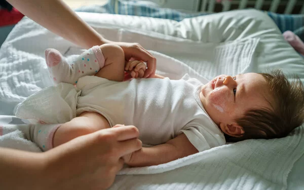 Baby mit Neurodermitis und Wundcreme im Gesicht, das auf einem Wickeltisch liegt.