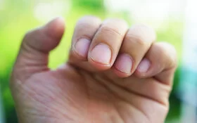 Nahaufnahme einer Hand mit gekrümmten Fingern: Die Nagelhaut der etwas ungepflegten Nägel ist leicht rissig.