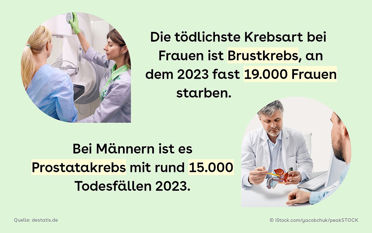 Das Bild zeigt die Früherkennungsuntersuchung einer Mammographie und ein Beratungsgespräch zu Prostatakrebs. Die tödlichste Krebsart bei Frauen ist Brustkrebs, an dem 2023 fast 19.000 Frauen starben. Bei Männern ist es Prostatakrebs mit rund 15.000 Toten im Jahr 2023.