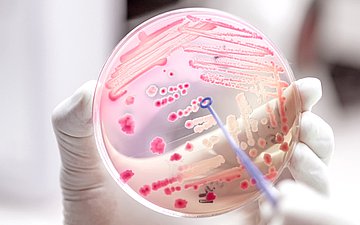 Sepsis Foto: Eine Petrischale mit Bakterien.