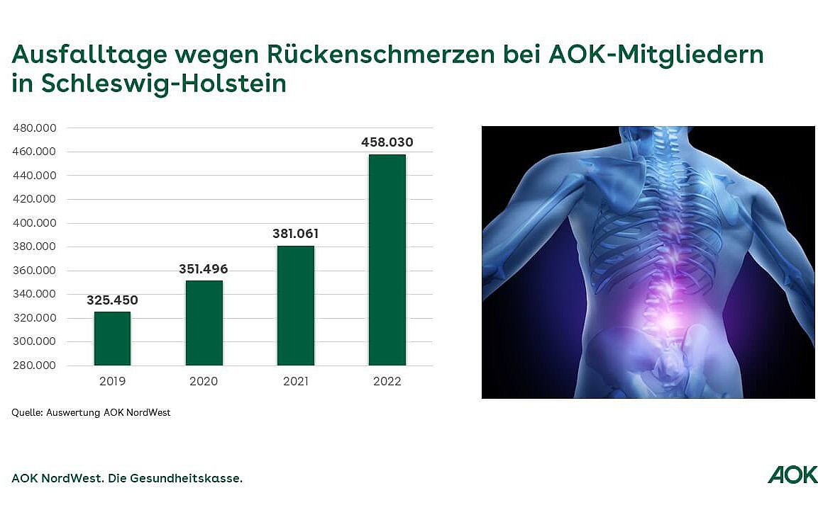 Eine Grafik zeigt die Ausfalltage wegen Rückenschmerzen bei AOK-Mitgliedern in Schleswig-Holstein.